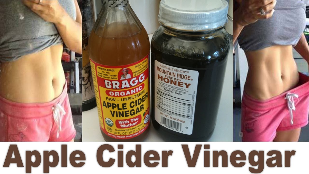 Apple Cider Vinegar Weight Loss Stories