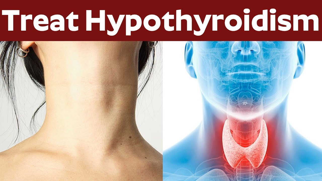 treat-hypothyroidism-what-happens-if-you-have-hypothyroidism