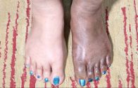 Feet Whitening Pedicure – Skin Whitening For Black Skin