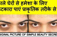 How To Get Rid Of Dark Circles In 3 Days – काले घेरे-  by Simple Beauty Secrets