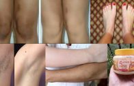 How To Lighten Your Dark Body Parts – Lighten Dark Knees – Elbows & Underarms