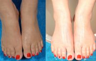 How To Make Your Feet Milky White & Beautiful Naturally At Home By Simple Beauty Secrets