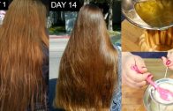 Magical Hair Regrowth Treatment, Cure Hair Loss, Cure Baldness, Stop Hair Fall