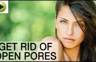 Natural Remedies for Open Pores