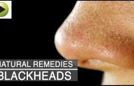 Skin Care – Blackheads – Natural Ayurvedic Home Remedies