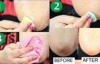 Skin Whitening For Dark Knees & Dark Elbows – LIVE RESULTS – by Simple Beauty Secrets
