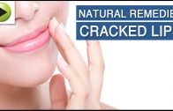 Cracked Lips – Natural Ayurvedic Home Remedies