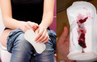 How To Stop Periods Pain Instantly – No More Painful Periods – Home Remedy For Irregular Periods