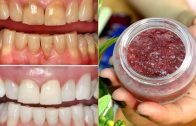 How To Whiten Your Dirty Yellowish Teeth Naturally – Teeth Whitening At Home