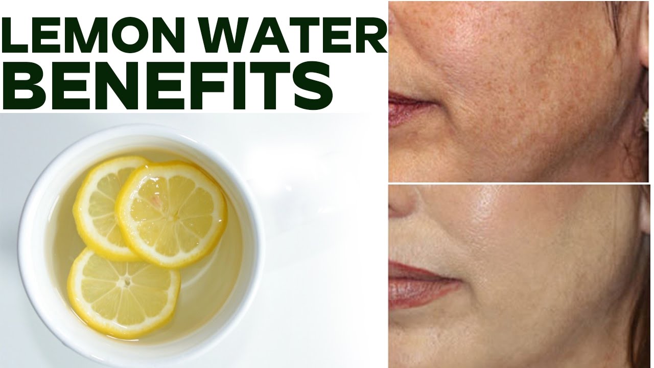 Lemon Water Benefits - Drinking Warm Lemon Water Every ...