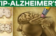 Natural Treatment For Alzheimer’s – Health Tips
