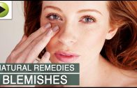 Skin Care – Clearing Skin Blemishes – Natural Ayurvedic Home Remedies