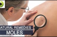 Skin Care – Moles – Natural Ayurvedic Home Remedies
