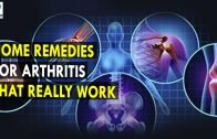 Home Remedies For Arthritis That Really Work – Health Sutra – Best Health Tips