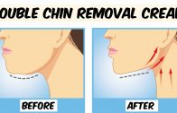 How To Get Rid of Double Chin – Double Chin Removal Cream – Remove Sagging Jawline
