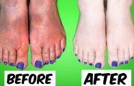 How To Get Soft, Beautiful, Younger Looking Hands & Feet in 5 Days