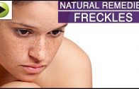 Skin Care – Freckles – Natural Ayurvedic Home Remedies