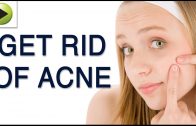 Skin Care – Home Remedies for Acne Treatment