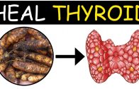 Thyroid Disease Can be Cured Permanently – Heal Thyroid Naturally – Orangehealth