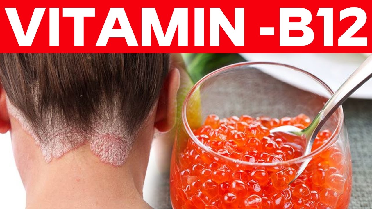 You Need to Know About Vitamin B12 - Benefits For Health, Skin, Hair ...