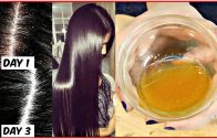 Apply This  Mixture On Your Scalp to Get Rid of Dandruff For Ever – Anti-Dandruff Home Remedy
