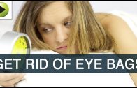 Natural Home Remedies For Eye Bags