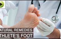 Skin Care – Athlete’s Foot – Natural Ayurvedic Home Remedies