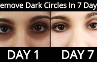 Top 5 Home Remedies To Remove Dark Circles Permanently In 7 Days – How To Remove Dark Circles