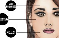 Why Do Women Get Facial Hair? – Expert Advice