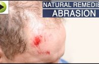 Skin Care – Abrasion – Natural Ayurvedic Home Remedies