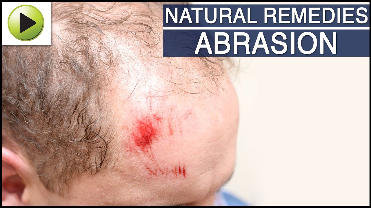 Skin Abrasion Treatment