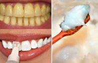 ये नुस्खा आपके गंदे पिले दांतो को एक मिनट में चमका देगा – Best Teeth Whitening Method