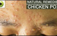 Skin Care – Chicken Pox – Natural Ayurvedic Home Remedies
