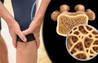 Osteoporosis Treatment &amp – Management – Get Healthy Bones
