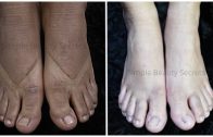 World’s Best Feet Whitening Remedy – Remove All The Sun Tan &amp – Darkness From Feet