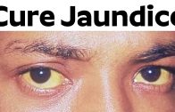 Cure Jaundice | Can Jaundice In Adults Be Cured