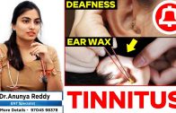 Tinnitus Causes- Effects &amp – Treatment – Sudden Deafness – Ear wax – ENT Specialist – Dr Anunya Reddy