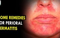 Home Remedies for Perioral Dermatitis – Health Sutra – Best Health Tips
