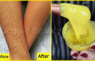 Korean Secret To Remove All Unwanted Hair From Face &amp – Body Permanentlyn – Hair Removal At Home