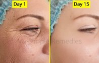 Japanese Antiaging Secret To Look 10 Years Younger – Antiaging remedy – Remove Wrinkes &amp – Acne